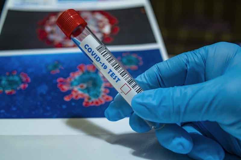 Montenegrin Authorities Have Eased Epidemiological Measures