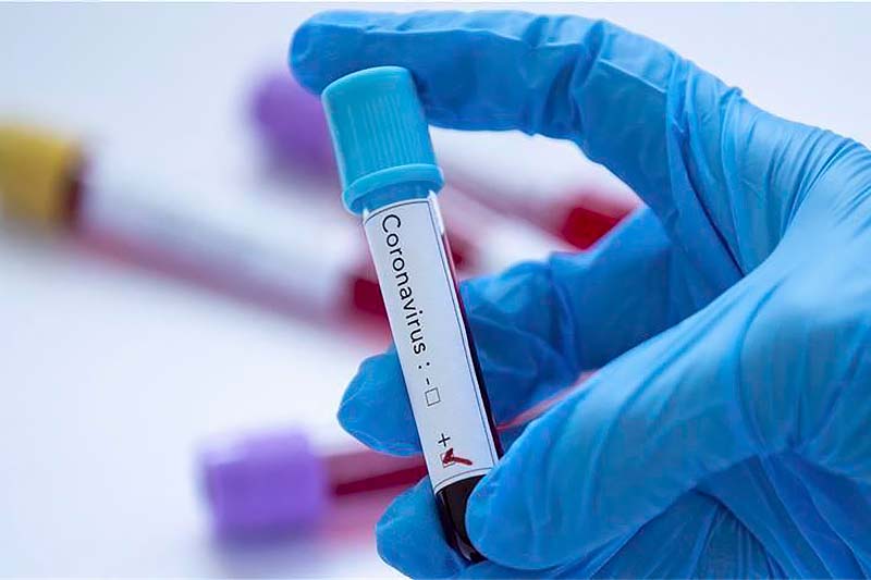 Quarantine Measures Tightened in Montenegro for 7 Days