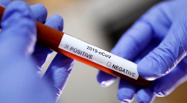The Number of Coronavirus Cases in Montenegro Exceeds 1,500