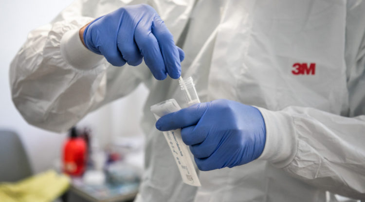 303 Coronavirus Infections Detected in Montenegro